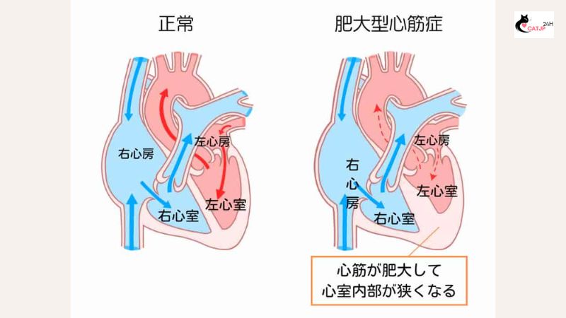 肥 大型 心筋 症 猫（HCM）の概要